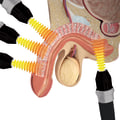 What is the success rate for shock wave therapy for ed?