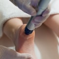 Can Shockwave Therapy be Repeated? - An Expert's Perspective