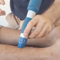 Shockwave Therapy: Is it a Long-Term Solution?