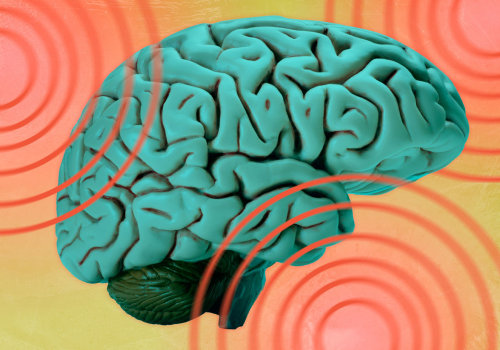 Can shockwaves cause brain damage?